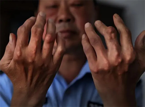 图片细节