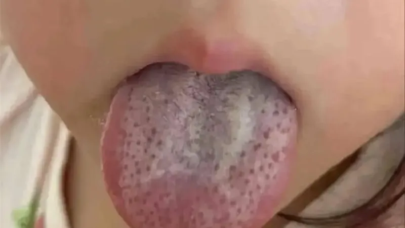 详细说明