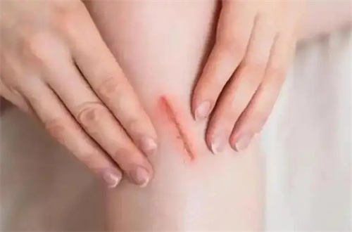 详细说明
